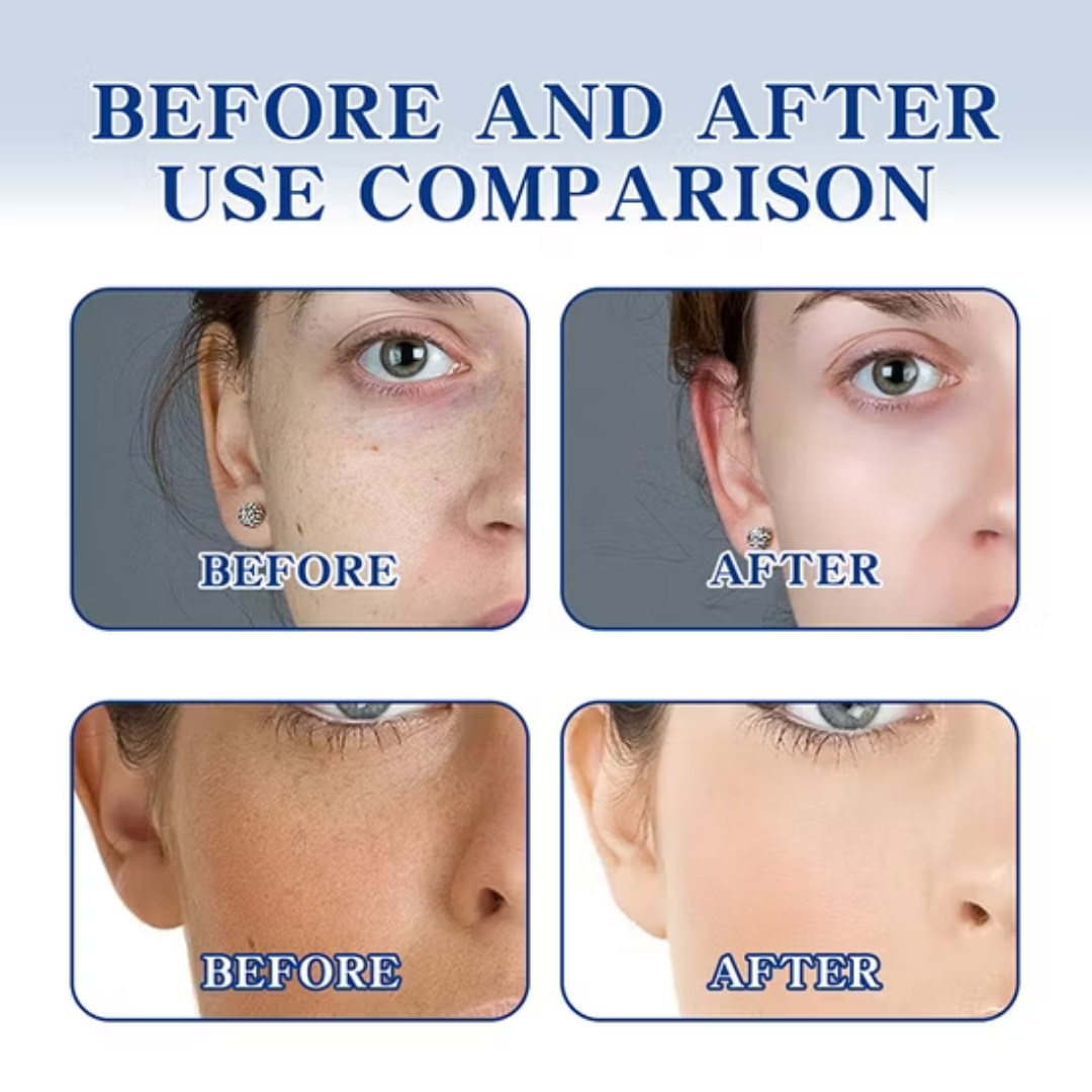 Chalonese Brightening Cream | (Both for Men & Women)